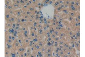 IHC-P analysis of Mouse Liver Tissue, with DAB staining. (CPT1A antibody  (AA 568-773))