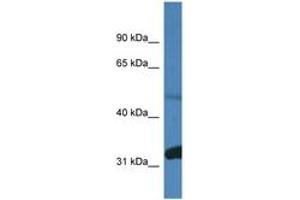 Image no. 1 for anti-Protein Phosphatase 2, Regulatory Subunit B, delta (PPP2R2D) (AA 380-429) antibody (ABIN6746439) (PPP2R2D antibody  (AA 380-429))
