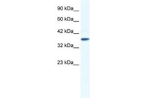 WB Suggested Anti-KCNK3 Antibody Titration:  1. (KCNK3 antibody  (C-Term))