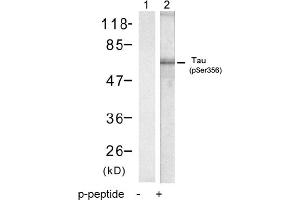 Image no. 1 for anti-Microtubule-Associated Protein tau (MAPT) (pSer356) antibody (ABIN319219) (MAPT antibody  (pSer356))