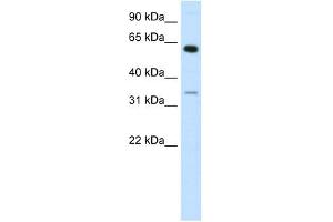 ZNF609 antibody (20R-1068) used at 0. (ZNF609 antibody  (N-Term))