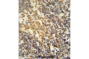 Immunohistochemistry analysis in formalin fixed and paraffin embedded human lymphnode using TNFAIP2 Antibody (Center) Cat. (TNFAIP2 antibody  (Middle Region))