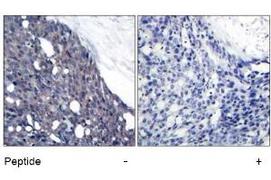 Image no. 1 for anti-Nuclear Factor of kappa Light Polypeptide Gene Enhancer in B-Cells Inhibitor, alpha (NFKBIA) (Tyr42) antibody (ABIN197391) (NFKBIA antibody  (Tyr42))