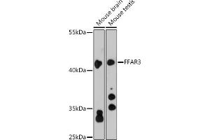 Western blot analysis of extracts of various cell lines, using FF antibody (ABIN6129724, ABIN6140586, ABIN6140587 and ABIN6216341) at 1:3000 dilution. (FFAR3 antibody  (AA 257-346))