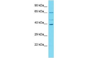Western Blotting (WB) image for anti-Chromosome 16 Open Reading Frame 59 (C16ORF59) (N-Term) antibody (ABIN2156469) (C16ORF59 antibody  (N-Term))