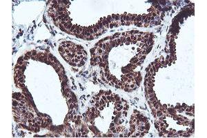 Immunohistochemical staining of paraffin-embedded Human breast tissue using anti-PSMB7 mouse monoclonal antibody. (PSMB7 antibody  (AA 58-277))