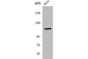 Western Blot analysis of HeLa cells using CARD 6 Polyclonal Antibody (CARD6 antibody  (N-Term))