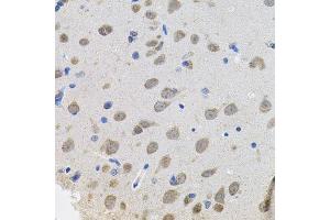 Immunohistochemistry of paraffin-embedded rat brain using VEPH1 antibody. (VEPH1 antibody  (AA 448-547))