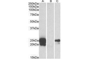 HEK293 lysate (10 µg protein in RIPA buffer) overexpressing Human WFDC2 with C-terminal MYC tag probed with AP22455PU-N (1 µg/ml) in Lane A and probed with anti-MYC Tag (1/1000) in lane C. (WFDC2 antibody  (Internal Region))
