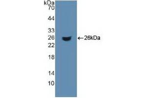 Detection of Recombinant ACO1, Human using Polyclonal Antibody to Aconitase 1 (ACO1) (Aconitase 1 antibody  (AA 26-243))