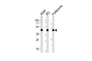 ACTA1/α-actin Antibody (C-term)  western blot analysis in A549,RD cell line and human placenta lysates (35 μg/lane). (Actin antibody  (C-Term))