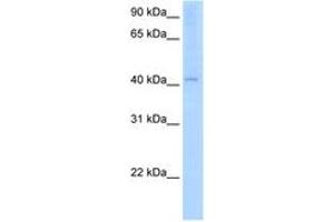 Image no. 1 for anti-Arylacetamide Deacetylase (Esterase) (AADAC) (AA 301-350) antibody (ABIN205073) (AADAC antibody  (AA 301-350))