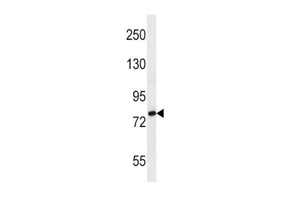 SLC9A2 antibody  (C-Term)