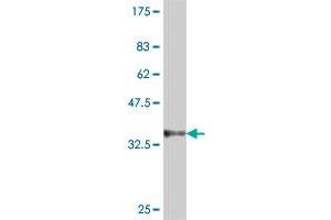 Western Blot detection against Immunogen (35. (Dystrobrevin beta antibody  (AA 1-89))