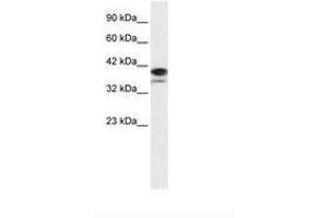 Image no. 1 for anti-Poly (ADP-Ribose) Polymerase Family, Member 6 (PARP6) (AA 72-121) antibody (ABIN202705) (PARP6 antibody  (AA 72-121))