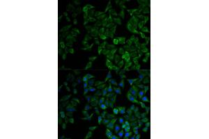 Immunofluorescence analysis of HeLa cells using TNFRSF1A antibody (ABIN1875131). (TNFRSF1A antibody)