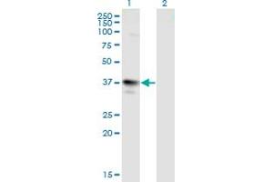 Western Blot analysis of MAGEA3 expression in transfected 293T cell line by MAGEA3 monoclonal antibody (M01), clone 6D10. (MAGEA3 antibody  (AA 44-114))