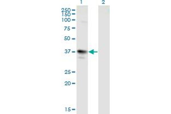 MAGEA3 Antikörper  (AA 44-114)