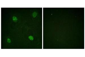 Immunofluorescence analysis of HeLa cells, using hnRPD (Phospho-Ser83) antibody. (HNRNPD/AUF1 antibody  (pSer83))