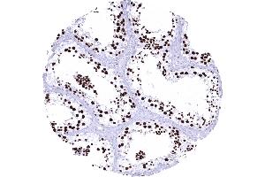 Spermatocyte of the testis subject to meiosis is the only normal cell type with a consistent strong TOPO2A expression in virtually all cells (Recombinant Topoisomerase II alpha antibody  (AA 1352-1493))