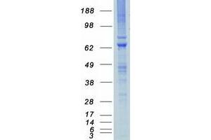 Validation with Western Blot