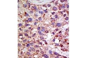 Image no. 1 for anti-Ubiquitin Specific Peptidase 11 (USP11) (N-Term) antibody (ABIN357538) (USP11 antibody  (N-Term))