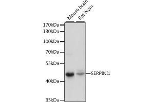 Western blot analysis of extracts of various cell lines, using SERPINI1 antibody (ABIN7270251) at 1:1000 dilution. (Neuroserpin antibody  (AA 181-410))