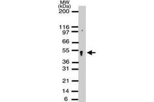 Western blot analysis of APEXL2 in HeLa cell lysates using APEX2 polyclonal antibody  at a dilution of 1 : 500. (APEX2 antibody)