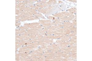 Immunohistochemistry of paraffin-embedded rat heart using  antibody (ABIN7265735) at dilution of 1:100 (40x lens).
