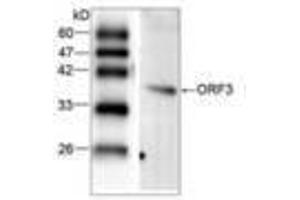 Image no. 1 for anti-Hepatitis E Virus (HEV) (AA 34-123) antibody (ABIN791327)
