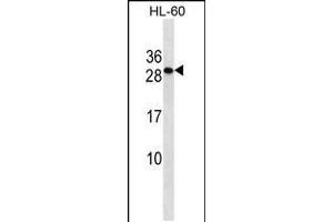 Western blot analysis in HL-60 cell line lysates (35ug/lane). (TMED6 antibody  (AA 125-153))