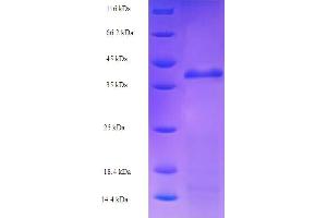 SDS-PAGE (SDS) image for RuvA (AA 1-203), (full length) protein (His-SUMO Tag) (ABIN5711038)