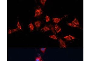 Immunofluorescence analysis of C6 cells using ADAM11 Polyclonal Antibody at dilution of 1:100. (ADAM11 antibody)
