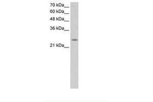 Image no. 2 for anti-Fatty Acid Hydroxylase Domain Containing 2 (FAXDC2) (N-Term) antibody (ABIN6736644) (C5ORF4 antibody  (N-Term))