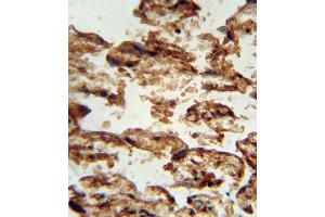 Immunohistochemistry (IHC) image for anti-Insulin-Like Growth Factor Binding Protein 4 (IGFBP4) antibody (ABIN3002898) (IGFBP4 antibody)
