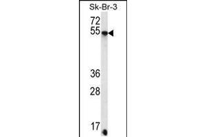 Western blot analysis in SK-BR-3 cell line lysates (35ug/lane). (SDC3 antibody  (C-Term))
