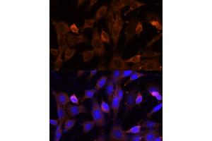 Immunofluorescence analysis of NIH-3T3 cells using VPS36 Polyclonal Antibody (ABIN7271277) at dilution of 1:100 (40x lens). (VPS36 antibody  (AA 70-220))