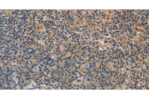 Immunohistochemistry of paraffin-embedded Human tonsil using FXYD1 Polyclonal Antibody at dilution of 1:60