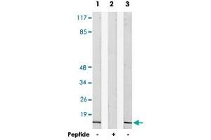 Western blot analysis of extracts from HepG2 cells (Lane 1 and lane 2) and RAW 264. (NDUFA4 antibody)