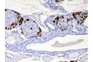 IHC analysis of RBP4 using anti-RBP4 antibody . (RBP4 antibody  (AA 19-201))