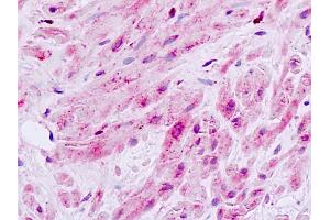 Human, Prostate, smooth muscle: Formalin-Fixed Paraffin-Embedded (FFPE) (MAP3K9 antibody  (Internal Region))