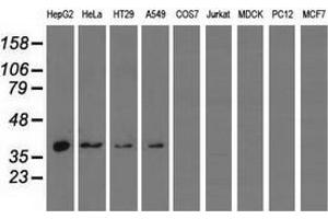 Western blot analysis of extracts (35 µg) from 9 different cell lines by using anti-HIBCH monoclonal antibody. (HIBCH antibody)