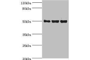 Western blot All lanes: TERF1 antibody at 2 μg/mL Lane 1: k562 whole cell lysate Lane 2: 293T whole cell lysate Lane 3: Jurkat whole cell lysate Secondary Goat polyclonal to rabbit IgG at 1/10000 dilution Predicted band size: 51, 49 kDa Observed band size: 51 kDa (TRF1 antibody  (AA 260-439))
