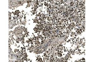 IHC analysis of FOXA2 using anti-FOXA2 antibody (ABIN7600003). (FOXA2 antibody  (AA 139-446))