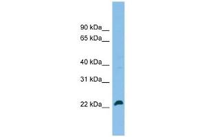 SPATA24 antibody used at 1 ug/ml to detect target protein. (SPATA24 antibody  (C-Term))