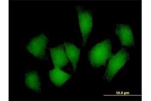 Immunofluorescence of purified MaxPab antibody to REM1 on HeLa cell. (REM1 antibody  (AA 1-298))