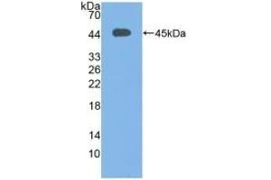 Detection of Recombinant C3c, Human using Polyclonal Antibody to Complement C3 Convertase (C3 Convertase) (Complement C3 Convertase antibody)