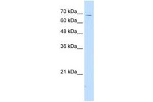 Image no. 1 for anti-Interleukin 18 Receptor Accessory Protein (IL18RAP) (AA 60-109) antibody (ABIN204987) (IL18RAP antibody  (AA 60-109))