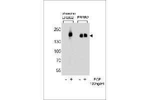 Western blot analysis of extracts from A431 cells,untreated or treated with EGF,100 ng/mL ,using phospho ERBB2-(left) or ERBB2 Antibody (right) (ErbB2/Her2 antibody  (pTyr1127))