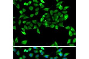 Immunofluorescence analysis of U2OS cells using EIF3H Polyclonal Antibody